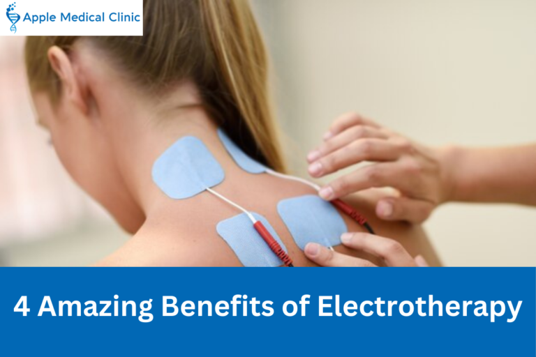 4 Amazing Benefits of Electrotherapy